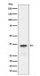 Anti-Lactate Dehydrogenase C Rabbit Monoclonal Antibody