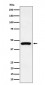 Anti-Cytokeratin 19 Rabbit Monoclonal Antibody