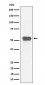 Anti-MEF2A Rabbit Monoclonal Antibody