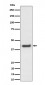 Anti-MVK Rabbit Monoclonal Antibody