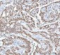Anti-RBM3 Rabbit Monoclonal Antibody