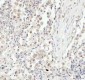 Anti-JNK1 Rabbit Monoclonal Antibody