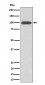 Anti-Integrin beta 3 / CD61 Rabbit Monoclonal Antibody