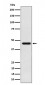 Anti-ACAT1 Rabbit Monoclonal Antibody