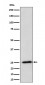 Anti-RPL10A Rabbit Monoclonal Antibody