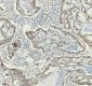 Anti-HNRNPM Rabbit Monoclonal Antibody