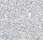 Anti-HNRNPM Rabbit Monoclonal Antibody