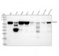 Anti-HNRNPM Rabbit Monoclonal Antibody