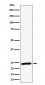 Anti-RAB8A Rabbit Monoclonal Antibody