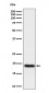 Anti-TNFAIP8 Rabbit Monoclonal Antibody