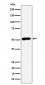 Anti-PPP2R5E Rabbit Monoclonal Antibody