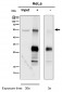 Anti-PPP2R5E Rabbit Monoclonal Antibody