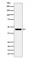 Anti-ACTR1B Rabbit Monoclonal Antibody