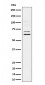 Anti-BIN1 Rabbit Monoclonal Antibody