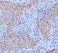 Anti-Desmoglein 2/DSG2 Antibody Picoband™ (monoclonal, 2B4D1)