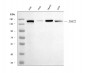 Anti-Desmoglein 2/DSG2 Antibody Picoband™ (monoclonal, 2B4D1)