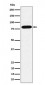 Anti-ABCD1 / ALD Rabbit Monoclonal Antibody