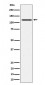 Anti-Phospho-JAK1 (Y1034 + Y1035) Rabbit Monoclonal Antibody