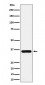 Anti-Gamma glutamyl hydrolase Rabbit Monoclonal Antibody