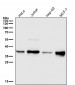 Anti-Gamma glutamyl hydrolase Rabbit Monoclonal Antibody