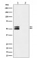 Anti-Phospho-CaMKII alpha (T286) Rabbit Monoclonal Antibody