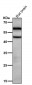 Anti-Phospho-CaMKII alpha (T286) Rabbit Monoclonal Antibody