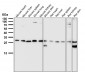 Anti-PDGF B Rabbit Monoclonal Antibody