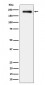 Anti-Phospho-EGFR (Y845) Rabbit Monoclonal Antibody