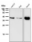 Anti-CXCR6 / CD186 Rabbit Monoclonal Antibody