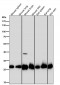 Anti-SDHB Rabbit Monoclonal Antibody