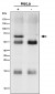 Anti-SYVN1 / HRD1 Rabbit Monoclonal Antibody