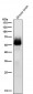 Anti-Phospho-Chk2 (S33 + S35) Rabbit Monoclonal Antibody