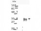 Anti-Cyclin D1 (RABBIT) Antibody