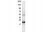 Anti-Human IL-6 (RABBIT) Antibody