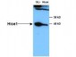 Anti-HICE1 (Rabbit) Antibody