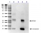 Anti-HbA (MOUSE) Monoclonal Antibody