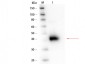 Anti-ALPHA-1-ACID GLYCOPROTEIN (Human Plasma) (RABBIT) Antibody