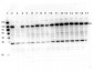 Anti-PARP1 (internal) (RABBIT) Antibody