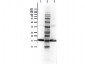 Anti-Human IL-1 Receptor Antagonist (RABBIT) Antibody