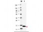 Anti-GM-CSF (RABBIT) Antibody