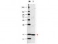 Anti-Human IL-17A (RABBIT) Antibody