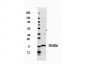 Anti-Human IL-1ß (RABBIT) Antibody