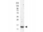 Anti-Human IL-2 (RABBIT) Antibody