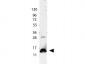 Anti-Human IL-9 (RABBIT) Antibody