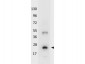 Anti-Human IL-32A (RABBIT) Antibody Peroxidase Conjugated