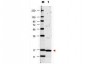 Anti-Human IL-17A (RABBIT) Antibody Biotin Conjugated