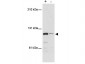 Anti-MTBP (Ascites) (MOUSE) Monoclonal Antibody