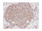 Anti-AKT pS473 (RABBIT) Antibody