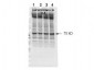 Anti-NF2 (Merlin) pS518 (RABBIT) Antibody