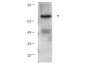 Anti-Protein Kinase C beta (RABBIT) Antibody